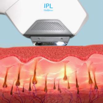 Intense Pulsed Light Therapy SHR Hair Removal Equipment IPL with Wavelength 430 / 530 / 640 ~ 1200nm