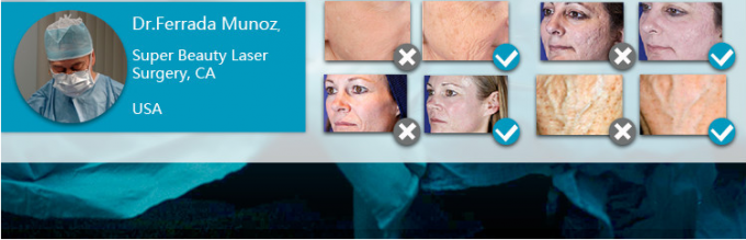 USA Coherent Metal Tube Co2 Fractional Laser Machine for Scar Removal