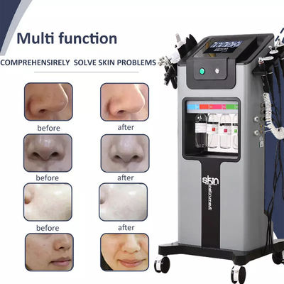 Black Pearl Kin Management Oxygen Facial Machine / Device Multifunction 500w