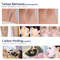 Portable Beauty Salon Laser Tattoo Removal Equipment 1064nm