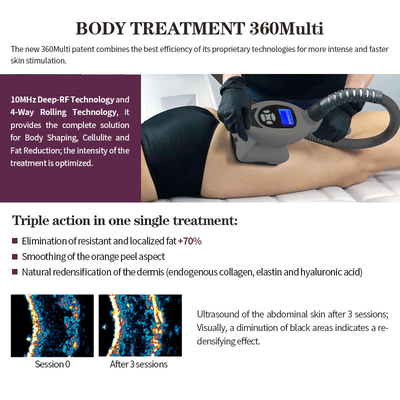 Vela Cellulite Treatment 4d Machine With Free Logo