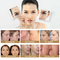 Multifunction 12x12mm Opt Machine Hair Removal Beauty Machine