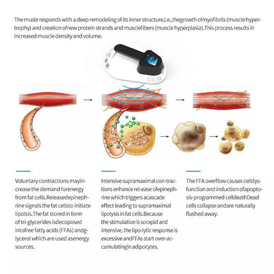 High Energy Ems Body Sculpting Machine For Weight Loss Muscle Stimulation Treatment
