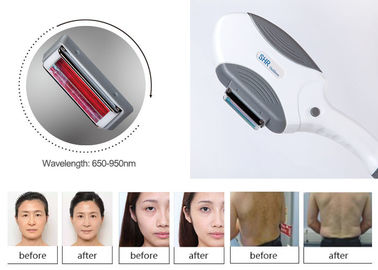 Pain Free Frequency SHR IPL Hair Removal Machine For Pigmented Lesions