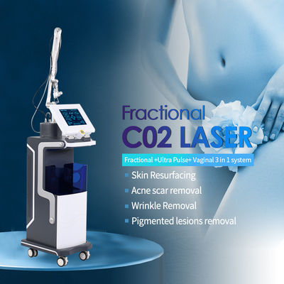 CO2 Fractional Laser Machine Most Advanced Solution For Scar Removal