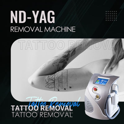 ND YAG Laser 1064nm 532nm Tattoo Removal Machine 1320nm Carbon Peeling