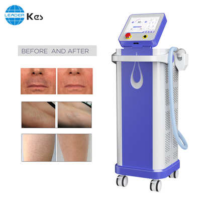 Diode Laser Hair Removal Machine Ice 808 1064 755nm 3 wavelength